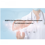 M2BPGi for Non-invasive Liver Fibrosis Assessment: