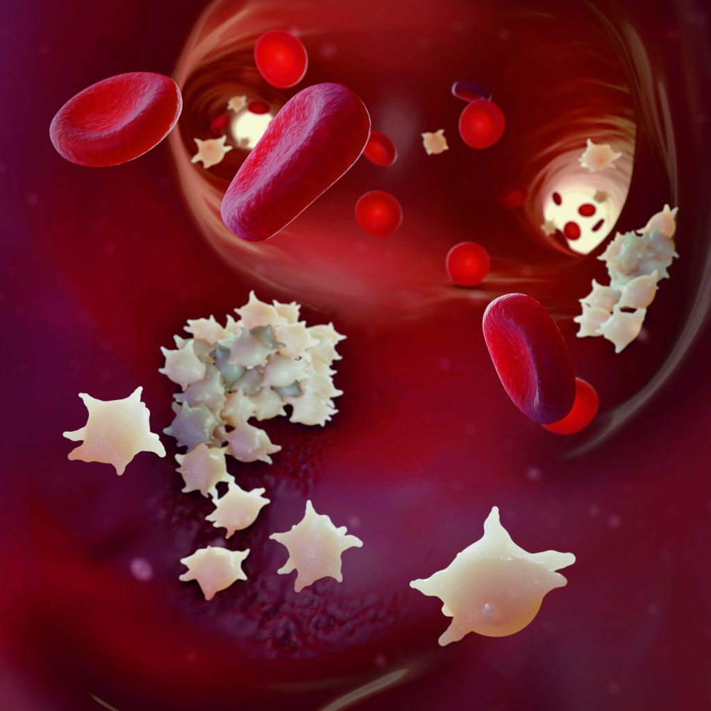 [VOD AVAILABLE] Von Willebrand Disease: New Guidelines on the Laboratory Diagnosis and Management