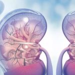 kidney