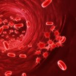 Optimising Lupus Anticoagulant Testing: From Algorithms to Guidelines
