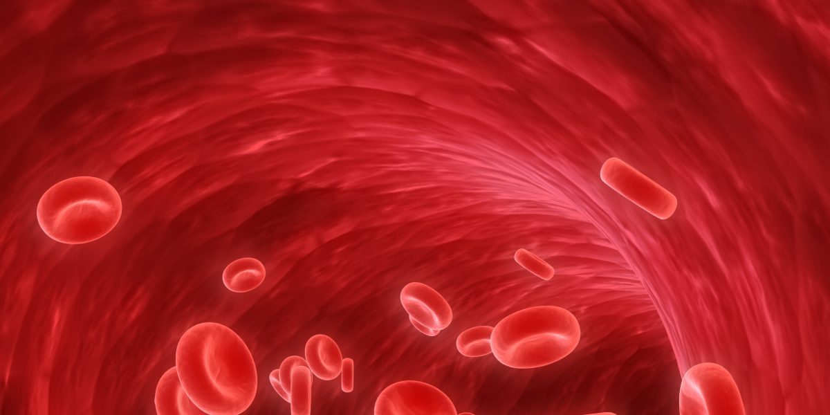 Optimising Lupus Anticoagulant Testing: From Algorithms to Guidelines